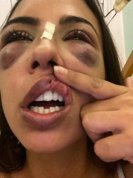 Mulher é agredida por dois homens durante briga em lancha