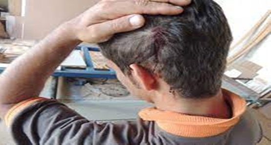 Adolescente é agredido a coronhadas por bandidos durante roubo de celular 