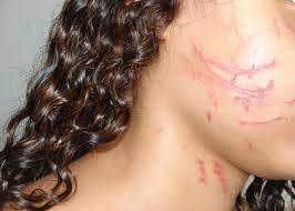 Adolescente tenta reatar relação com ex-marido mas é surrada por ele