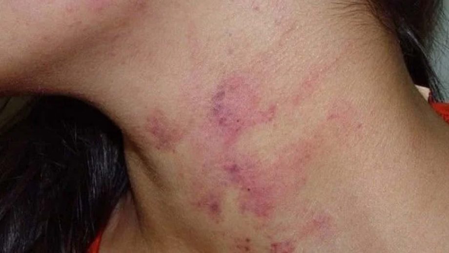 Mulher é agredida pelo marido ao se negar a manter relação sexual com ele
