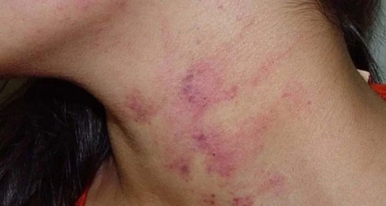 Homem espanca mulher após desconfiar de traição enquanto estava preso