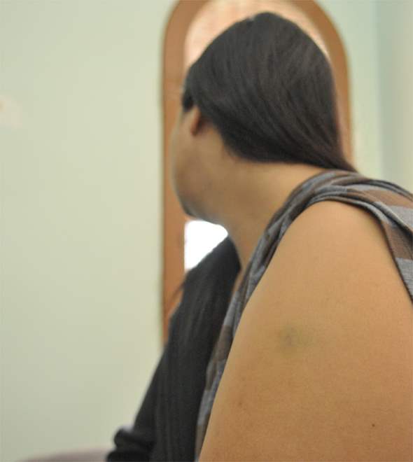Mulher é agredida por morador de rua depois de negar dinheiro 