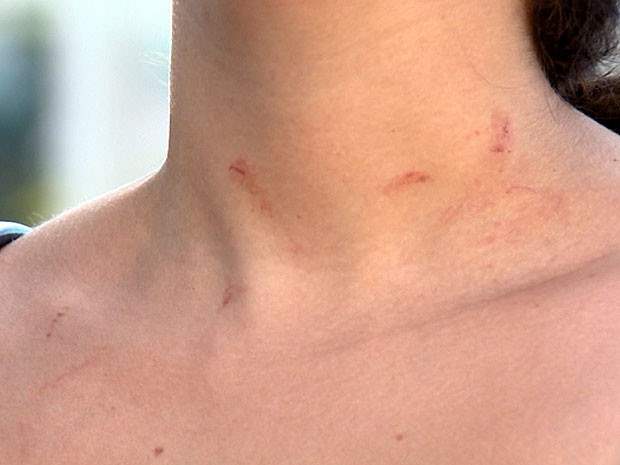 Homem amanhece bebendo chega em casa e agride a esposa