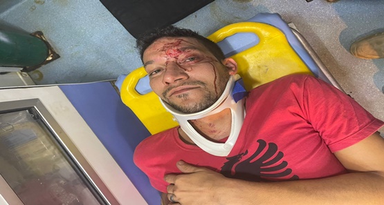Homem acusado de matar professora é encontrado morto no Urso Branco