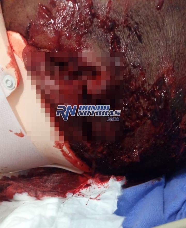 Homem sofre tentativa de homicídio a tijoladas durante bebedeira 
