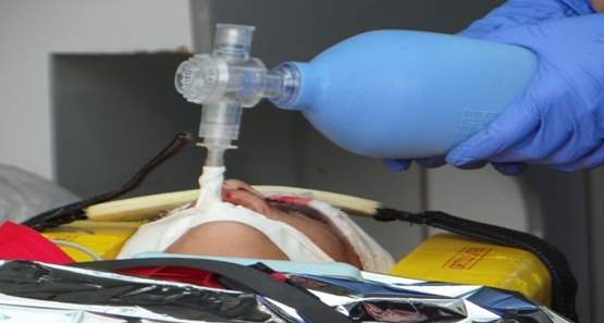 Mulher tenta matar o pai desligando aparelho de respiração mecânica