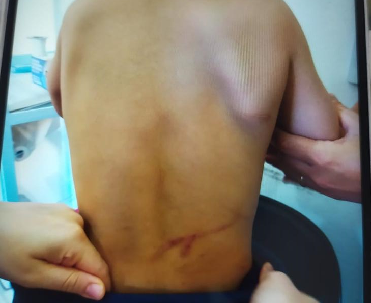 Mãe suspeita de torturar os filhos em Arapongas volta para cadeia