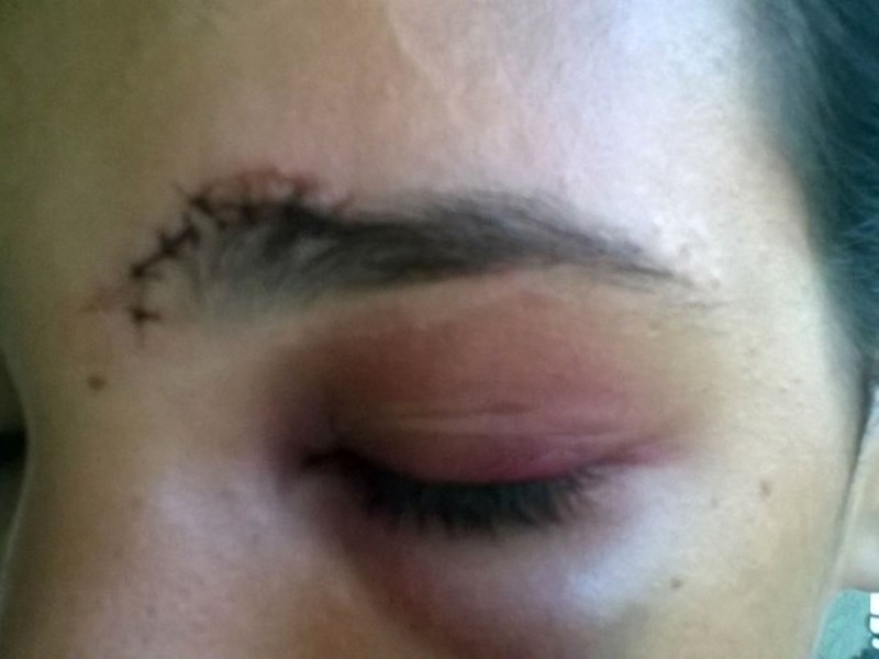 Mulher é espancada pelo próprio filho após discussão na zona leste 
