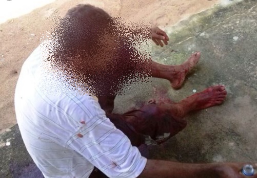 Jovem é encontrado ensanguentado no meio da rua na zona leste  