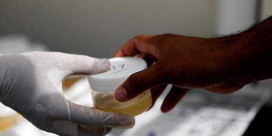 Brasileiros criam teste de urina mais preciso que exame de sangue na detecção de anticorpos