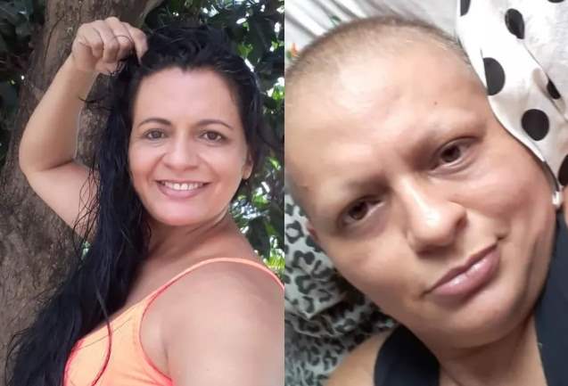 Mulher descobre câncer avançado meses após procurar ajuda e médico dizer que era gordura 