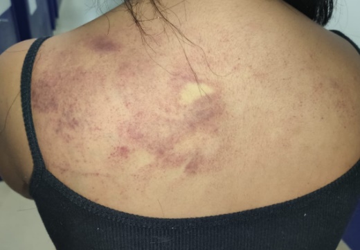 Mulher é espancada pelo marido após discussão na zona leste 