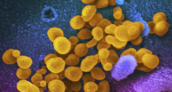 Infecção pela ômicron não garante imunidade contra outras variantes em não vacinados, aponta estudo
