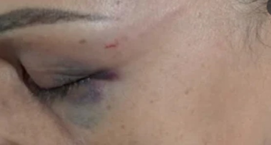 Mulher é agredida e tem moto roubada pelo ex-marido na capital 
