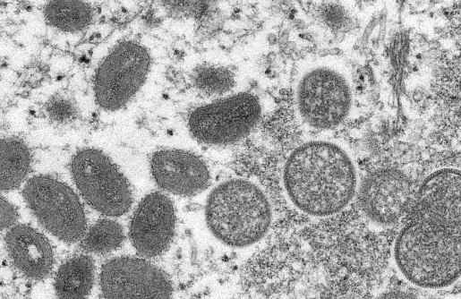 Brasil tem 592 casos confirmados de varíola dos macacos; veja lista de sintomas e como se proteger
