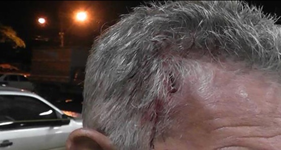 Bandidos violentos agridem e roubam  empresário durante assalto na capital