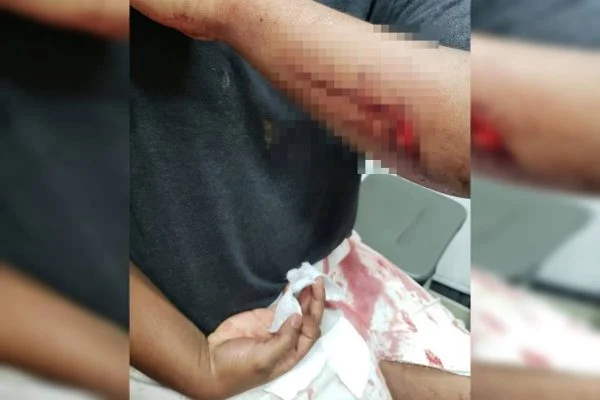 Avô atinge a própria neta grávida com golpes de facão após discussão em família