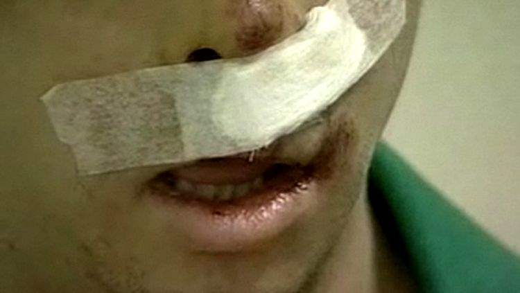 Portador de necessidades especiais é agredido por homem em residência 