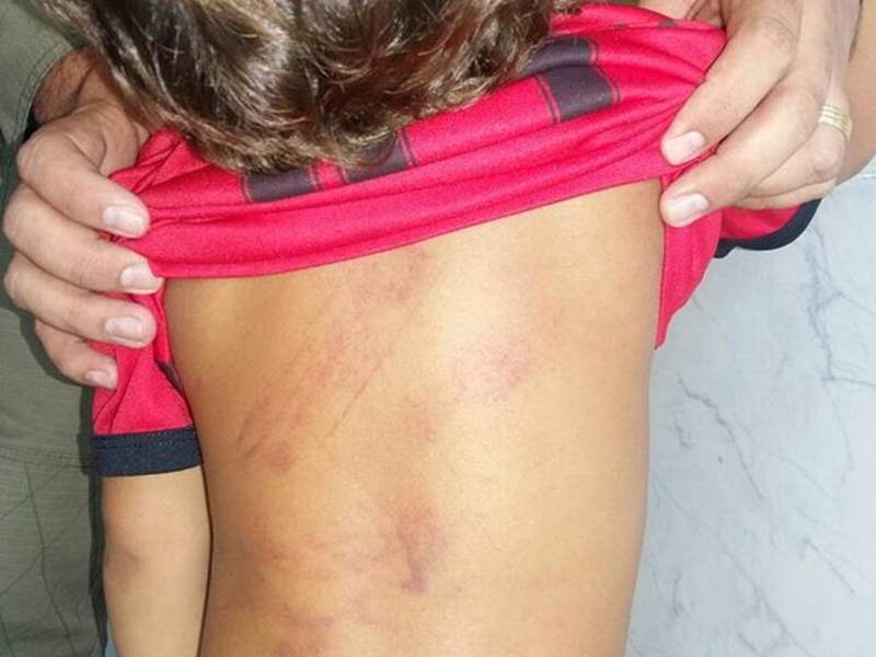 Mãe e padrasto são presos por espancar criança em residencial na zona Sul