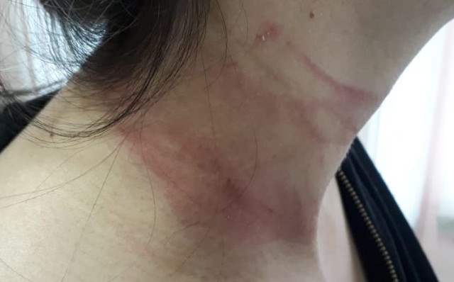 Homem com carabina em casa é preso após espancar sua esposa na zona sul