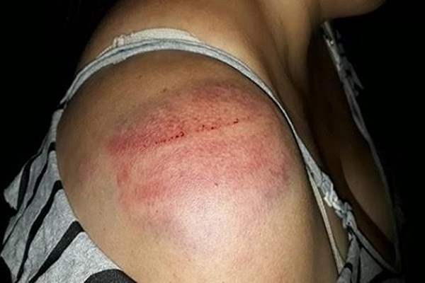 Sobrinha é agredida por tia em frente a casa da mãe