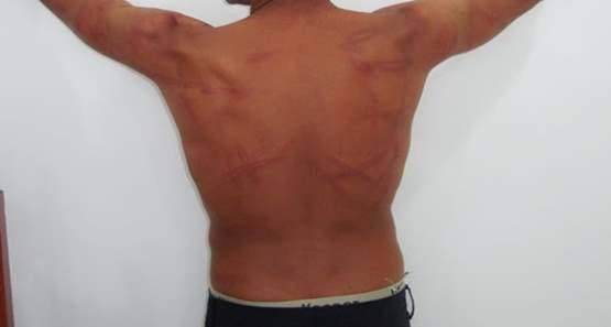 Mototaxistas surram jovem que o acusaram de esconder ladrão em seu terreno