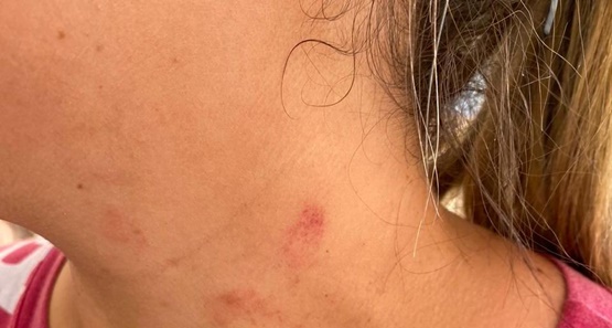 Viciado chega em casa alterado e surra a mulher por negar relação sexual