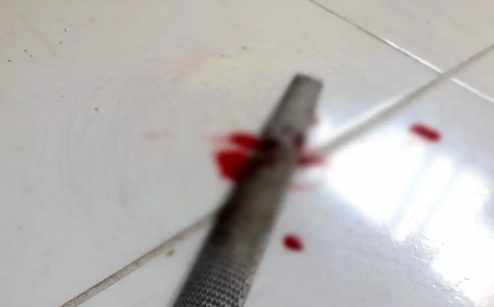 Idoso é agredido com barra de ferro pelo filho na zona leste de Porto Velho 