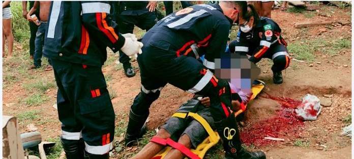 Jovem sofre tentativa de homicídio com tiro na cabeça,no Monte Sinai