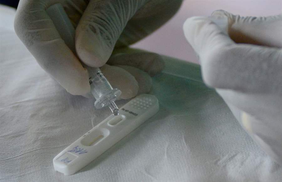 Anvisa concede o primeiro registro de produto para Autoteste de Covid-19 no Brasil