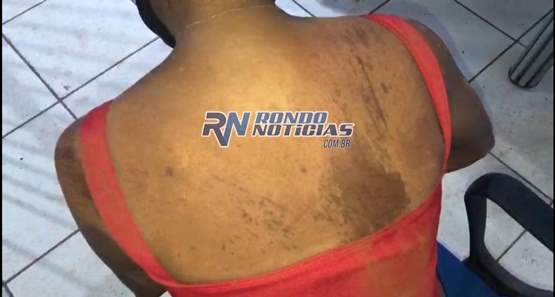 Homem leva facada no abdômen após agredir mulher e arrastá-la 