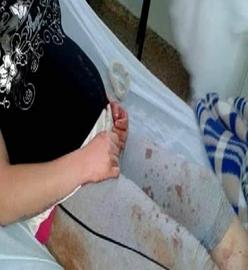 Ex-marido espanca mulher na rua para provocar aborto
