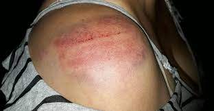 Marido chega em casa tarde e é agredido pela esposa com pauladas e cadeiradas