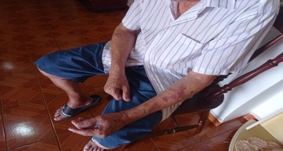 Idoso vive momentos de terror nas mãos de bandido durante assalto
