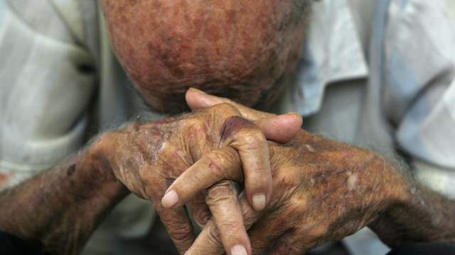 Filho de 31 anos agride a pauladas pai de 74 anos em casa na capital
