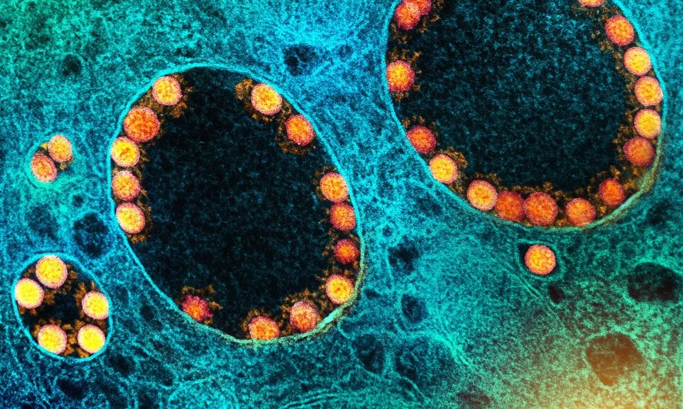 Reinfecção por coronavírus mais do que dobra risco de morte, com grupo na faixa dos 60 anos
