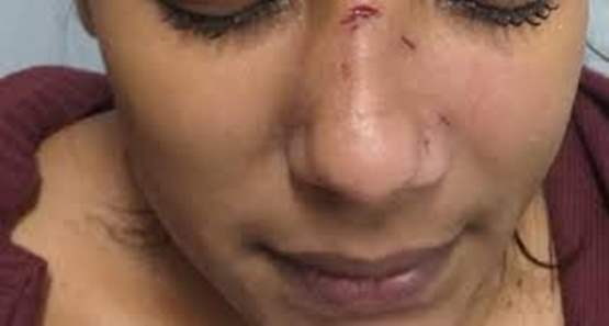 Homem agride ex-mulher por ter beijado outro e lhe chamado de corno