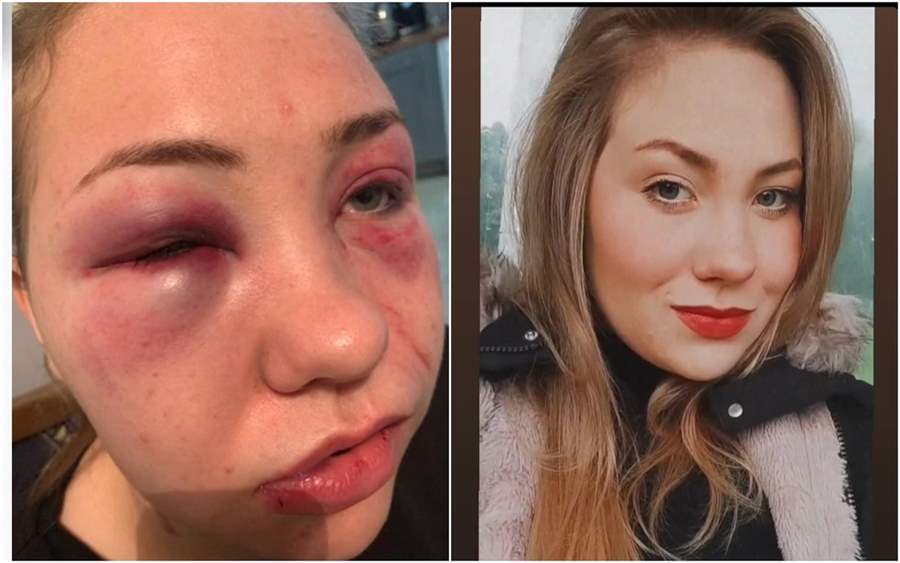 Goiano que confessou ter agredido a namorada é preso na Irlanda