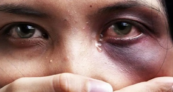 Mulher é agredida a socos e chutes pelo marido na zona sul da capital