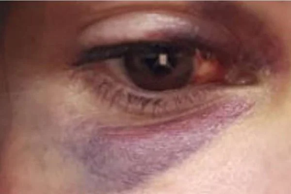 Marido acorda mulher com socos após suposta traição e acaba preso em flagrante