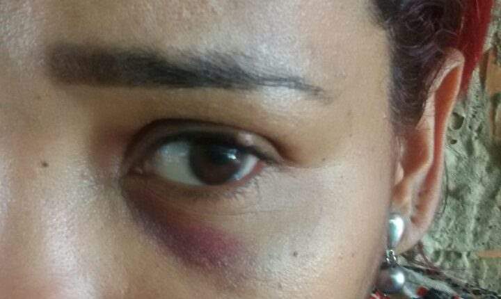 Mulher é surrada por sair de casa e ir beber com as amigas em Porto Velho