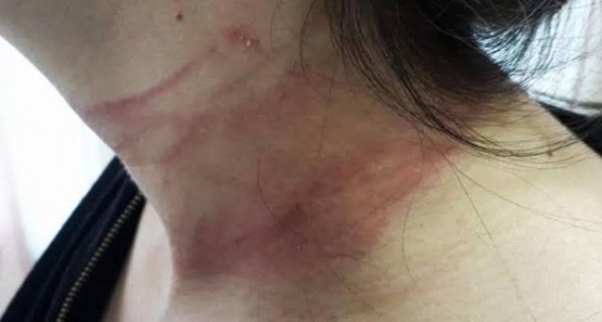 Homem pede para buscar pertences e estrangula ex-mulher em Porto Velho
