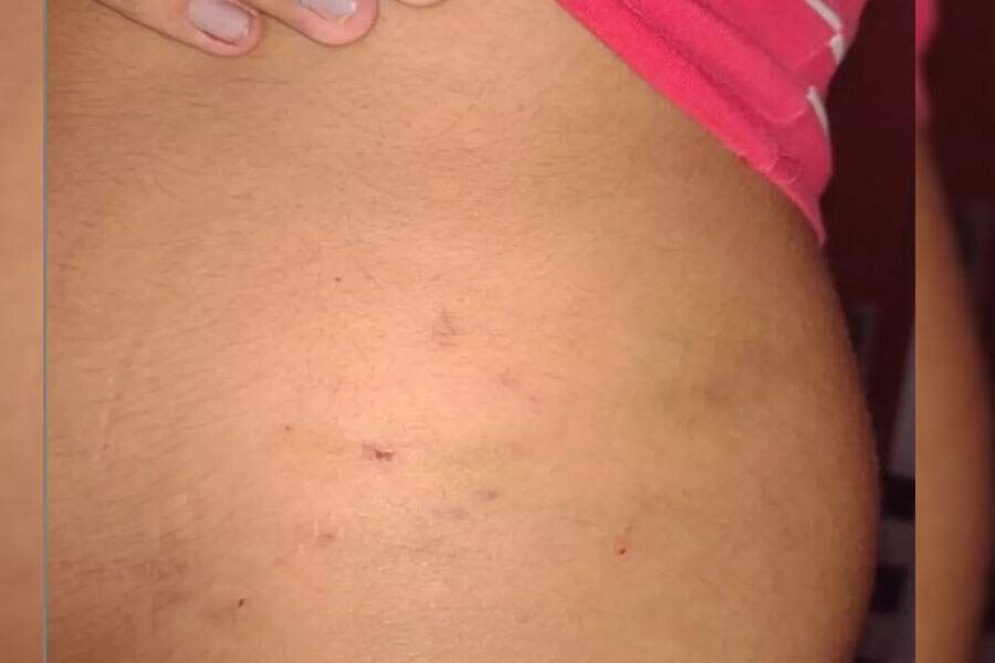 Garota de 16 anos denuncia que foi estuprada por oito homens e polícia investiga