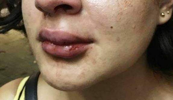 Marido espanca mulher por negar dinheiro para comprar drogas