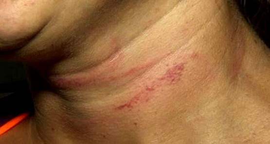 Homem é preso após espancar mulher e enteado durante bebedeira