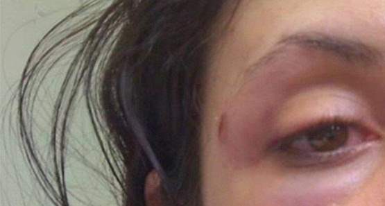 Homem furioso surra esposa porque cobrou dívida de sua mãe na capital 