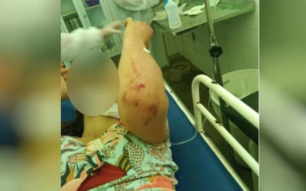 Homem é preso após agredir a mulher por quatro horas e tentar matá-la em casa