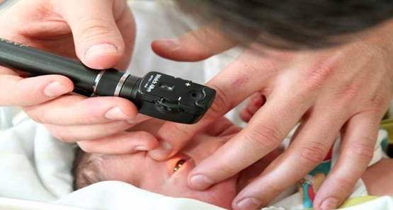 Saiba sobre o retinoblastoma, doença que pode ser diagnosticada cedo