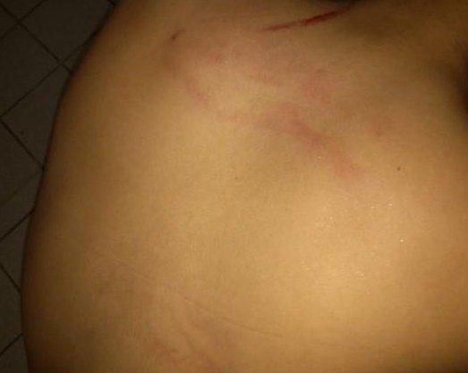 Adolescente é espancado pelo padrasto após defender mãe em briga 