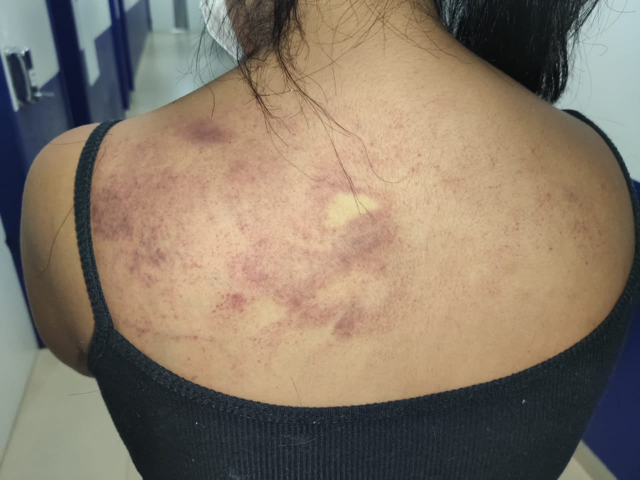 Mulher se nega a entregar celular para marido e é agredida na zona leste 